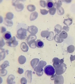 Normoblastos ortocromaticos