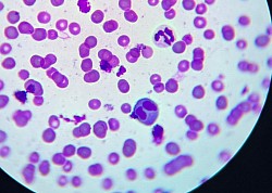 Eosinófilo